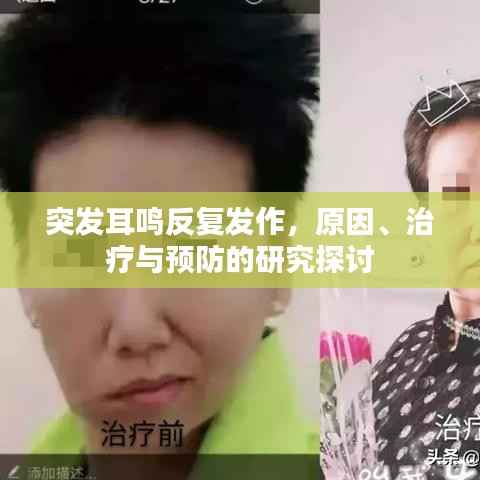 突发耳鸣反复发作，原因、治疗与预防的研究探讨